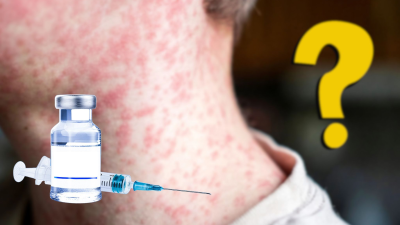 Sarampión en México: ¿Quiénes deben vacunarse y quienes no?