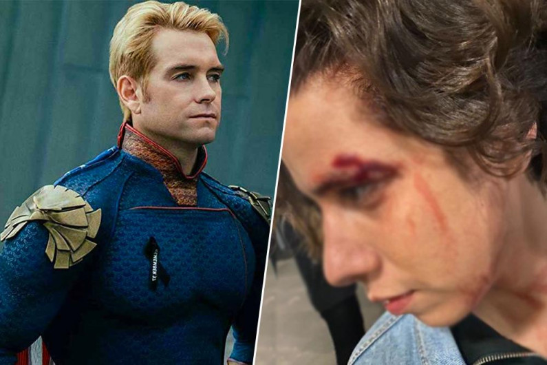 Detienen a Antony Starr, protagonista de ‘The Boys’ en España