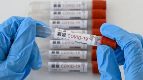 Condado Cameron pide a los residentes a informar resultados de pruebas de COVID en el hogar