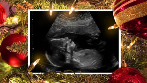 Meghan Trainor anuncia que espera su primer bebé con Daryl Sabara 