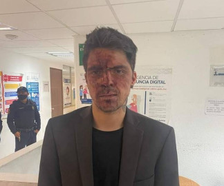 César D’Alessio acusa a Arturo Montiel de golpearlo tras un evento