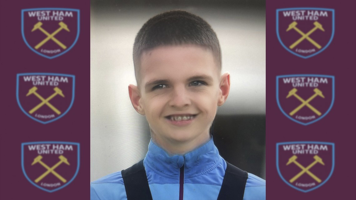 Presume West Ham foto de 'Chicharito' con filtro de bebé