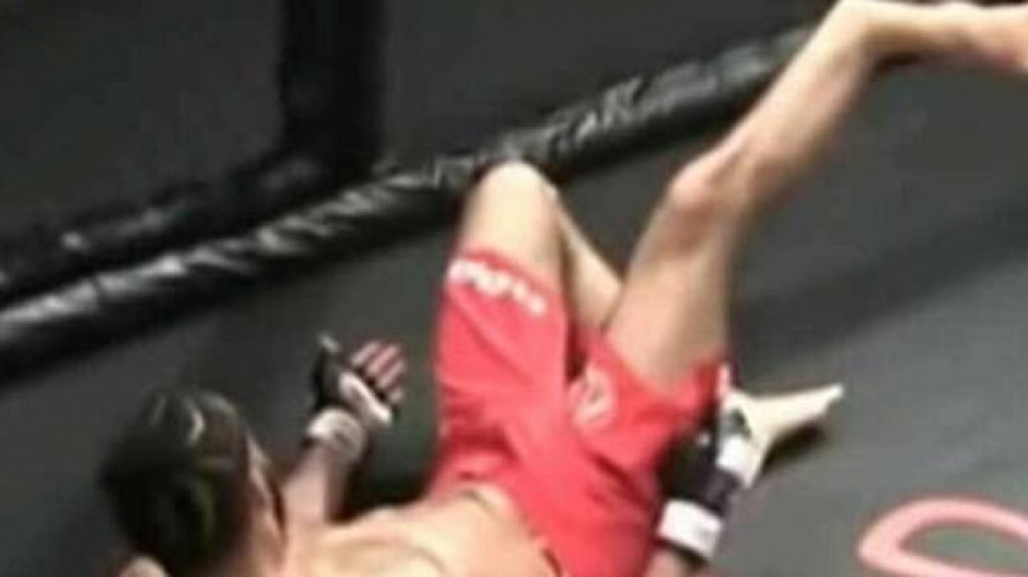 Escalofriante lesión que sufrió peleador de MMA 