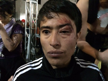 Golpean a activista en marcha; acusa a Frente Popular Francisco Villa