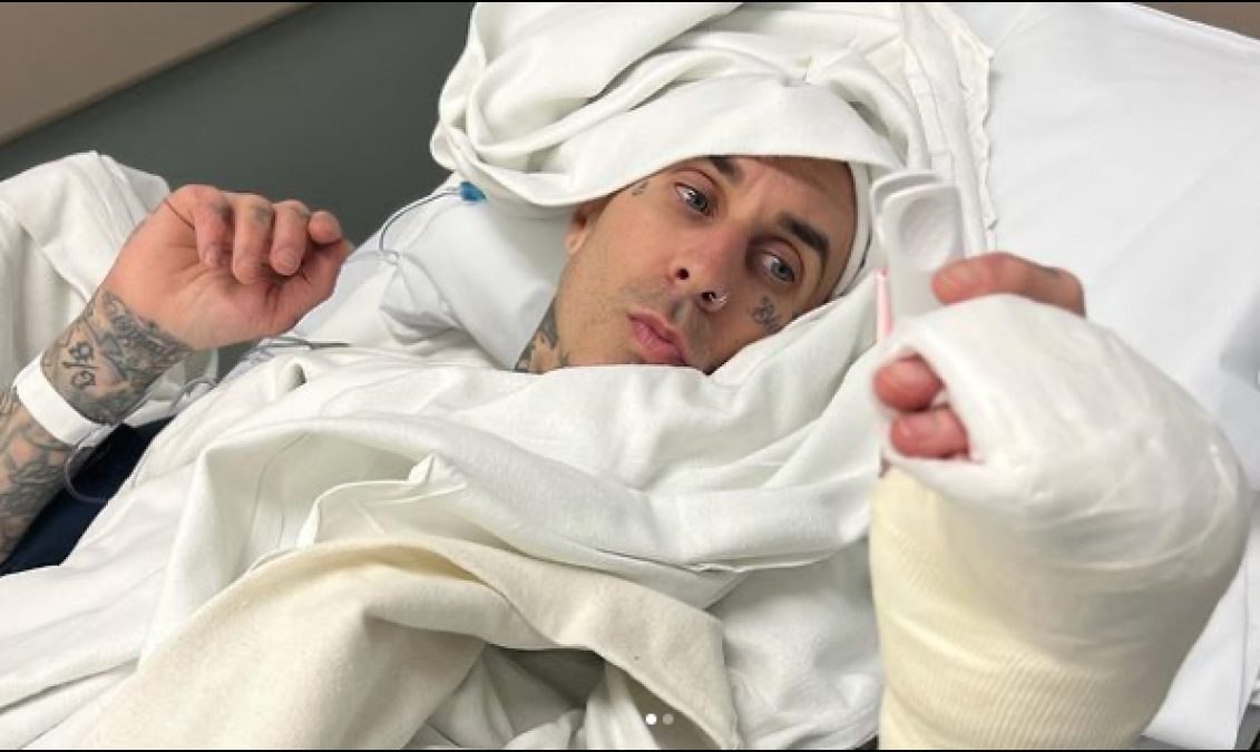 Travis Barker comparte foto de su operación del dedo