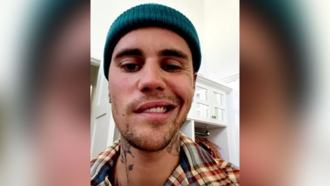 Justin Bieber fue diagnosticado con un síndrome raro