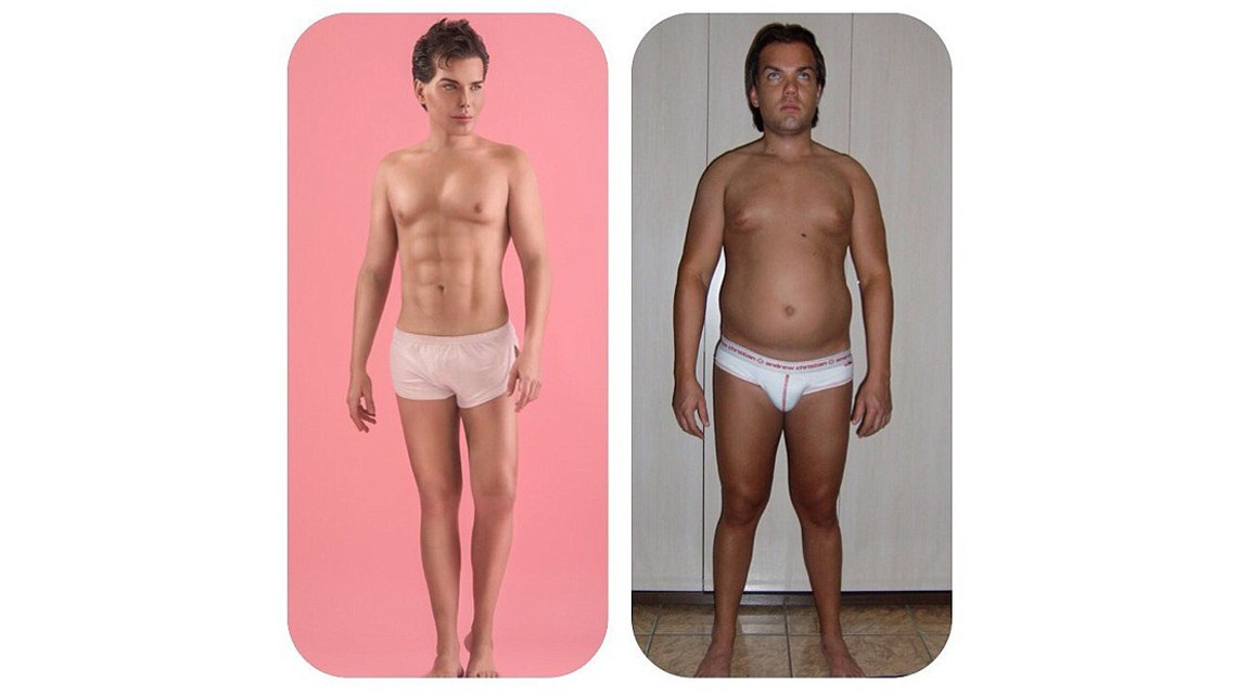 El "Ken humano" tiene complicaciones para respirar