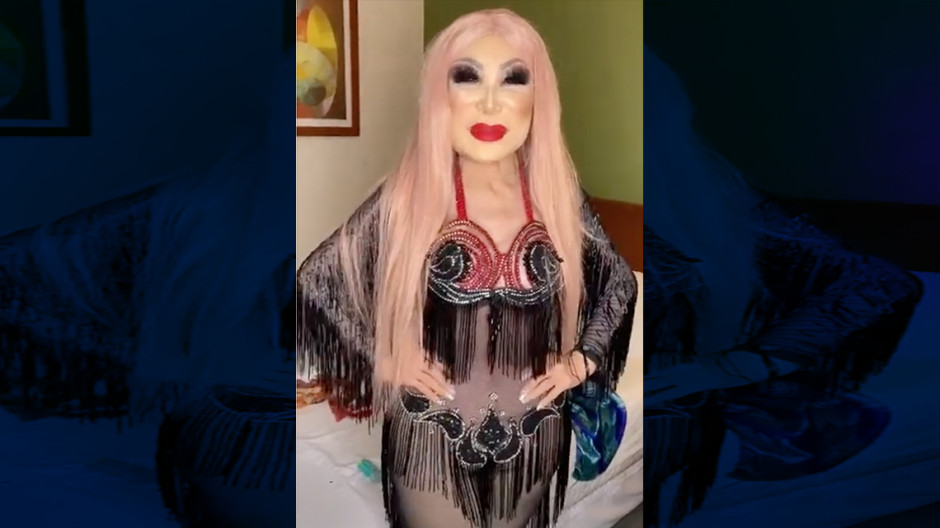 Lyn May invita a sus seguidores a ponerse botox