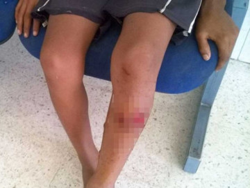 Se salva menor de ser devorado por cocodrilo