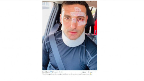 Scaloni sufre accidente sin gravedad en Mallorca
